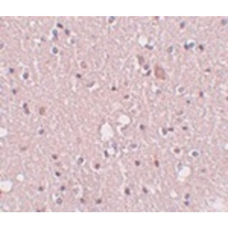 Immunohistochemistry - SIPA1L2 Antibody from Signalway Antibody (25007) - Antibodies.com