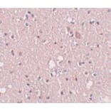 Immunohistochemistry - SIPA1L2 Antibody from Signalway Antibody (25007) - Antibodies.com