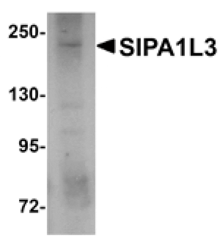 Western blot - SIPA1L3 Antibody from Signalway Antibody (25008) - Antibodies.com