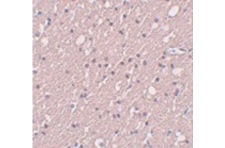 Immunohistochemistry - SIPA1L3 Antibody from Signalway Antibody (25008) - Antibodies.com