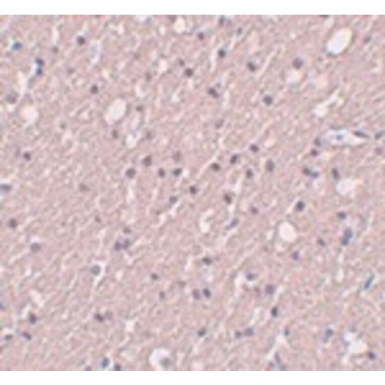 Immunohistochemistry - SIPA1L3 Antibody from Signalway Antibody (25008) - Antibodies.com