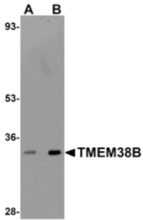 Western blot - TMEM38B Antibody from Signalway Antibody (25019) - Antibodies.com