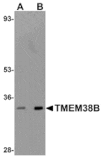 Western blot - TMEM38B Antibody from Signalway Antibody (25019) - Antibodies.com