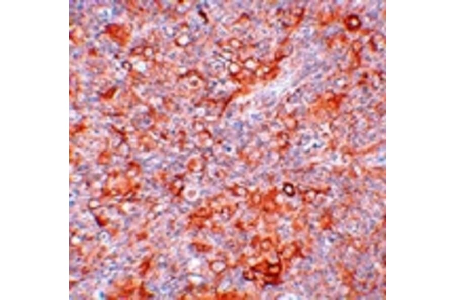 Immunohistochemistry - TMEM38B Antibody from Signalway Antibody (25019) - Antibodies.com