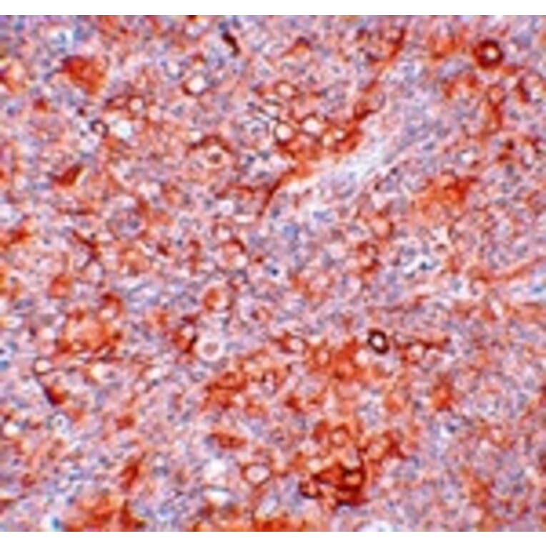 Immunohistochemistry - TMEM38B Antibody from Signalway Antibody (25019) - Antibodies.com