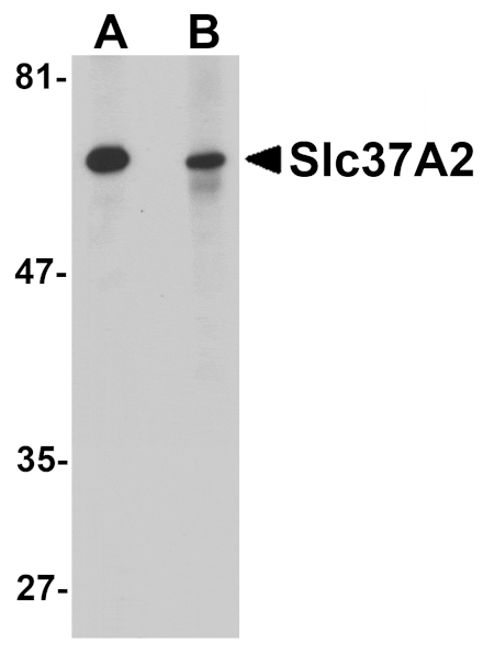 Western blot - Slc37A2 Antibody from Signalway Antibody (25074) - Antibodies.com