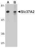 Western blot - Slc37A2 Antibody from Signalway Antibody (25074) - Antibodies.com