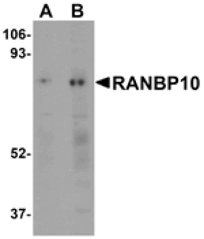 Western blot - RANBP10 Antibody from Signalway Antibody (25081) - Antibodies.com
