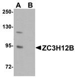Western blot analysis of ZC3H12B in mouse brain tissue lysate with ZC3H12B antibody at 1 µg/mL in (A) the absence and (B) the presence of blocking peptide.