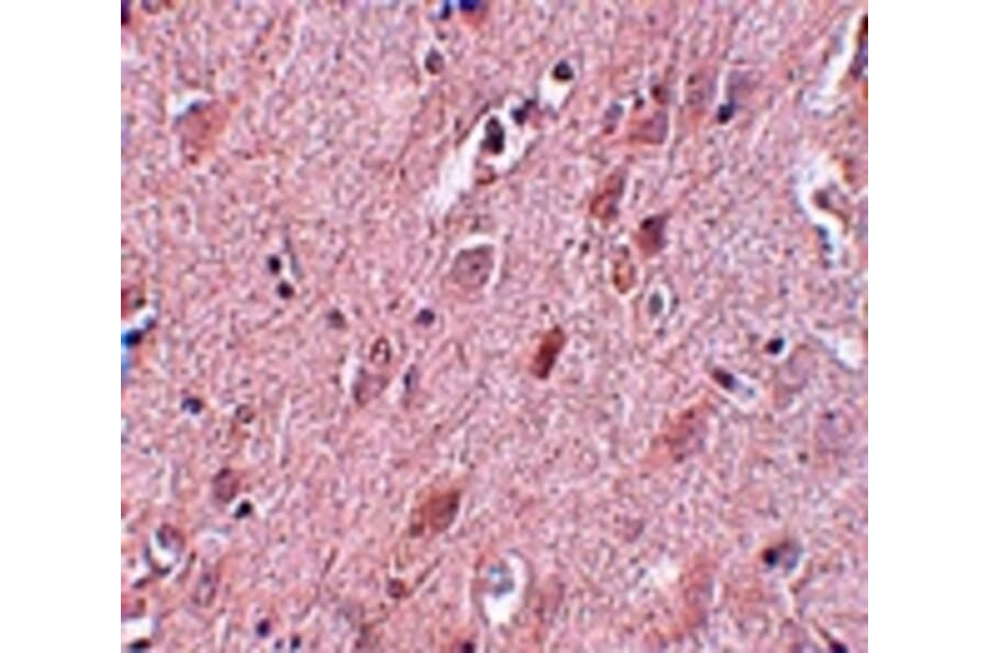 Immunohistochemistry - ZC3H12B Antibody from Signalway Antibody (25086) - Antibodies.com
