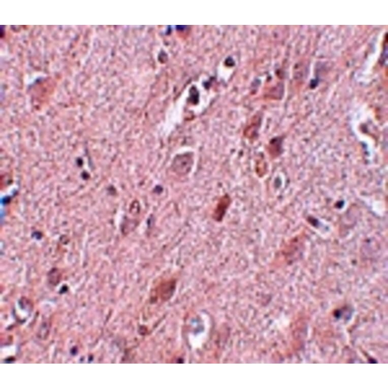 Immunohistochemistry - ZC3H12B Antibody from Signalway Antibody (25086) - Antibodies.com