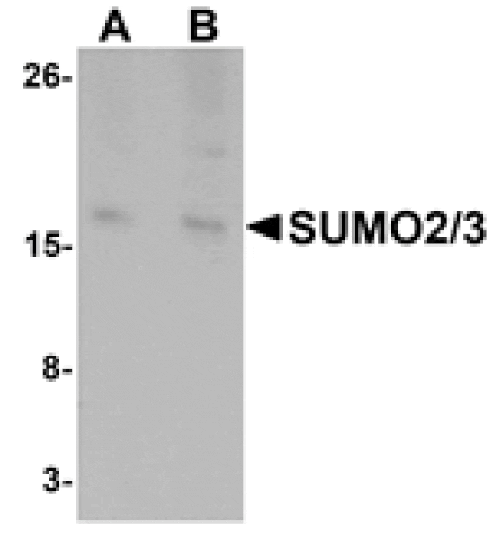 Western blot - SUMO2/3 Antibody from Signalway Antibody (25117) - Antibodies.com