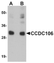 Western blot - CCDC106 Antibody from Signalway Antibody (25162) - Antibodies.com
