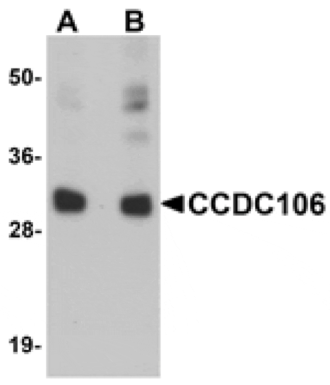 Western blot - CCDC106 Antibody from Signalway Antibody (25162) - Antibodies.com