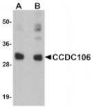 Western blot - CCDC106 Antibody from Signalway Antibody (25162) - Antibodies.com