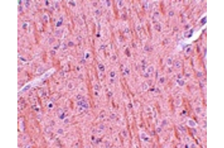 Immunohistochemistry - CCDC106 Antibody from Signalway Antibody (25162) - Antibodies.com