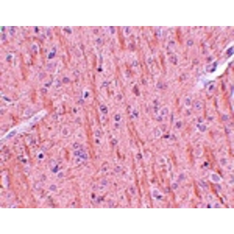 Immunohistochemistry - CCDC106 Antibody from Signalway Antibody (25162) - Antibodies.com