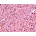 Immunohistochemistry - CCDC106 Antibody from Signalway Antibody (25162) - Antibodies.com