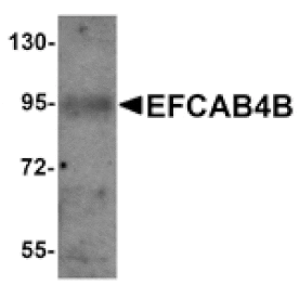 Western blot - EFCAB4B Antibody from Signalway Antibody (25215) - Antibodies.com