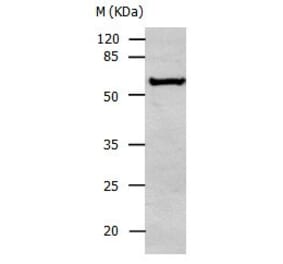 ALDH1A2 Antibody from Signalway Antibody (31007) - Antibodies.com