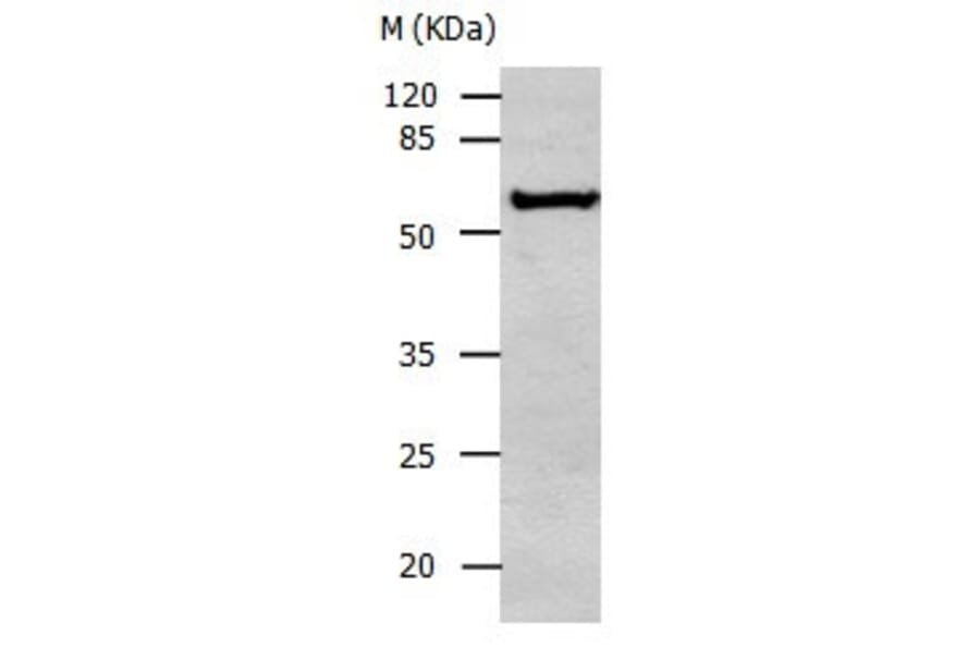 ALDH1A2 Antibody from Signalway Antibody (31007) - Antibodies.com