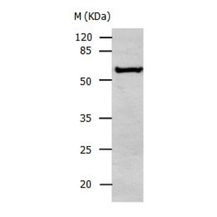 ALDH1A2 Antibody from Signalway Antibody (31007) - Antibodies.com