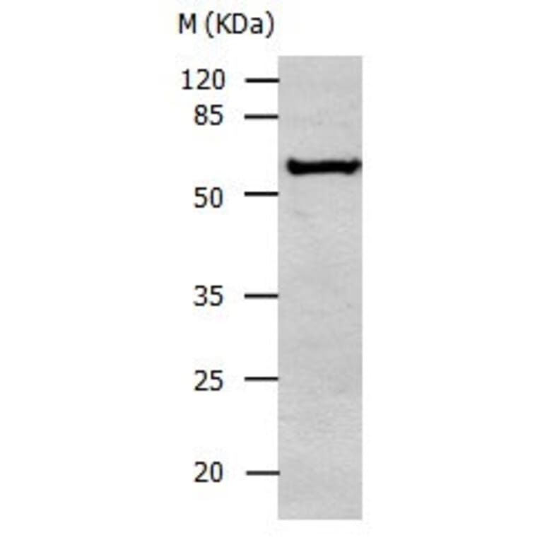 ALDH1A2 Antibody from Signalway Antibody (31007) - Antibodies.com