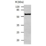 ALDH1A2 Antibody from Signalway Antibody (31007) - Antibodies.com