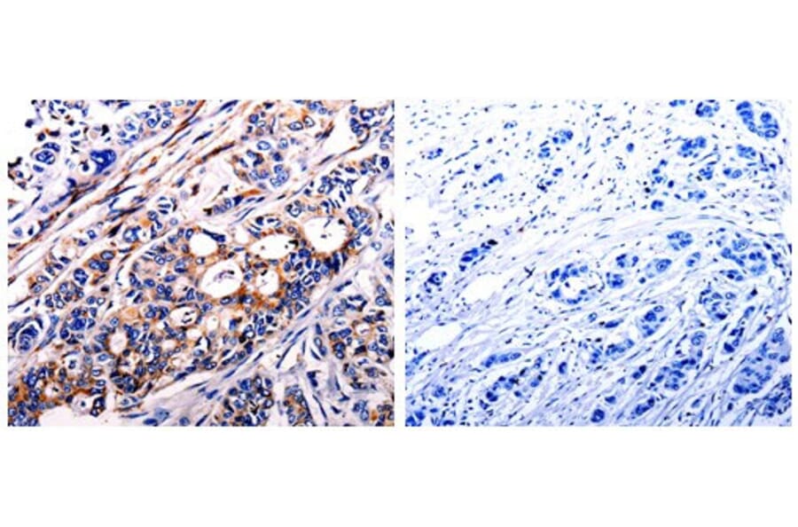 ALDH1A2 Antibody from Signalway Antibody (31007) - Antibodies.com