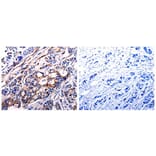 ALDH1A2 Antibody from Signalway Antibody (31007) - Antibodies.com