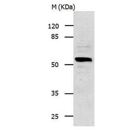 IL13RA1 Antibody from Signalway Antibody (31021) - Antibodies.com
