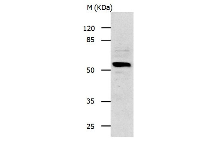 IL13RA1 Antibody from Signalway Antibody (31021) - Antibodies.com