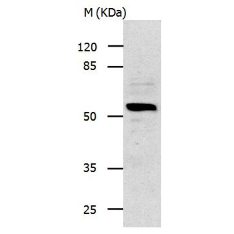 IL13RA1 Antibody from Signalway Antibody (31021) - Antibodies.com