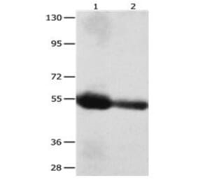 CEACAM1 Antibody from Signalway Antibody (31056) - Antibodies.com