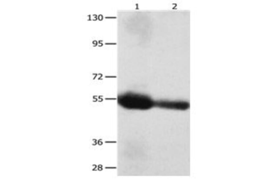 CEACAM1 Antibody from Signalway Antibody (31056) - Antibodies.com