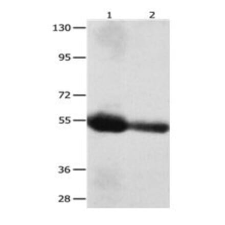 CEACAM1 Antibody from Signalway Antibody (31056) - Antibodies.com