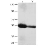CEACAM1 Antibody from Signalway Antibody (31056) - Antibodies.com