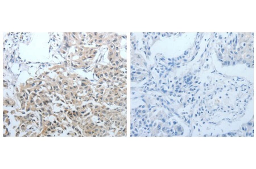 CEACAM1 Antibody from Signalway Antibody (31056) - Antibodies.com