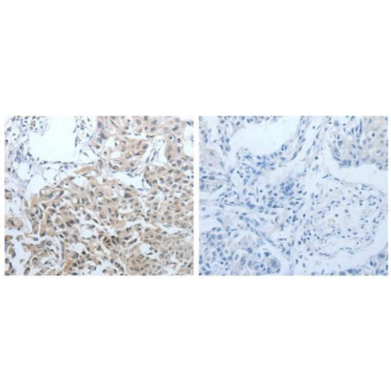CEACAM1 Antibody from Signalway Antibody (31056) - Antibodies.com