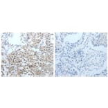 CEACAM1 Antibody from Signalway Antibody (31056) - Antibodies.com