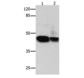 CSNK2A1 Antibody from Signalway Antibody (31057) - Antibodies.com