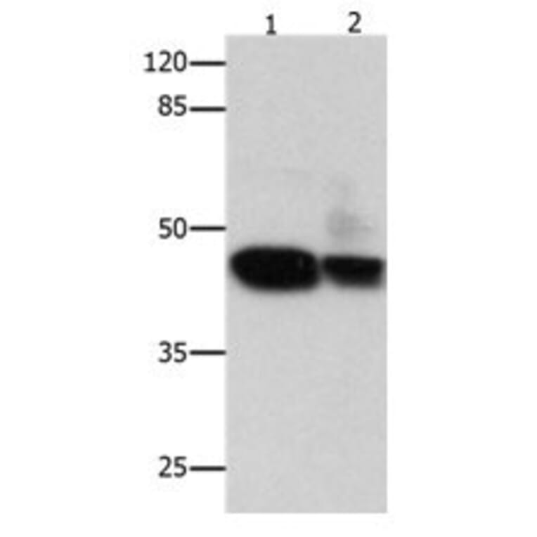 CSNK2A1 Antibody from Signalway Antibody (31057) - Antibodies.com