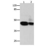 CSNK2A1 Antibody from Signalway Antibody (31057) - Antibodies.com