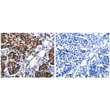 CSNK2A1 Antibody from Signalway Antibody (31057) - Antibodies.com
