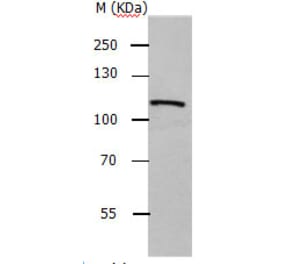 ADAMTS5 Antibody from Signalway Antibody (31158) - Antibodies.com