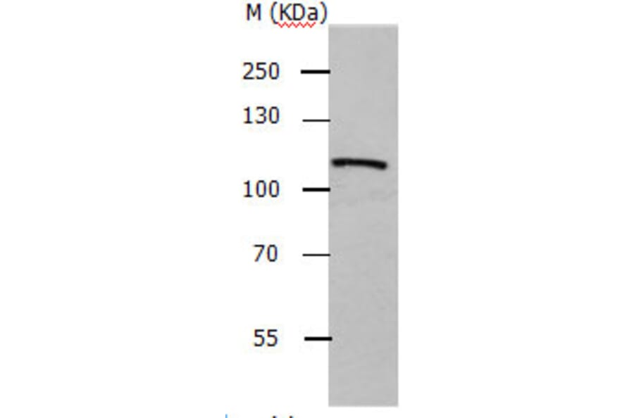 ADAMTS5 Antibody from Signalway Antibody (31158) - Antibodies.com