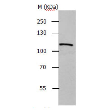 ADAMTS5 Antibody from Signalway Antibody (31158) - Antibodies.com