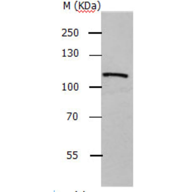 ADAMTS5 Antibody from Signalway Antibody (31158) - Antibodies.com