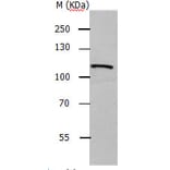 ADAMTS5 Antibody from Signalway Antibody (31158) - Antibodies.com