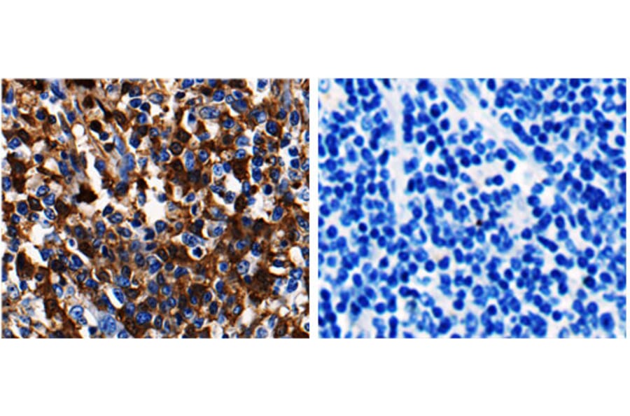 ADAMTS5 Antibody from Signalway Antibody (31158) - Antibodies.com